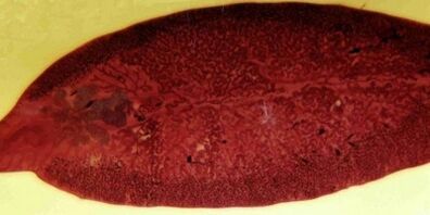 parazitul trematod cum se elimina din organism
